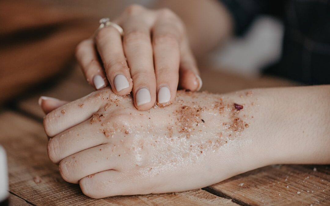 dermatitis natural treatment