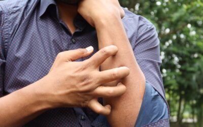 Soft Wear, Less Flare: Cotton Clothing Tips for Dermatitis Relief