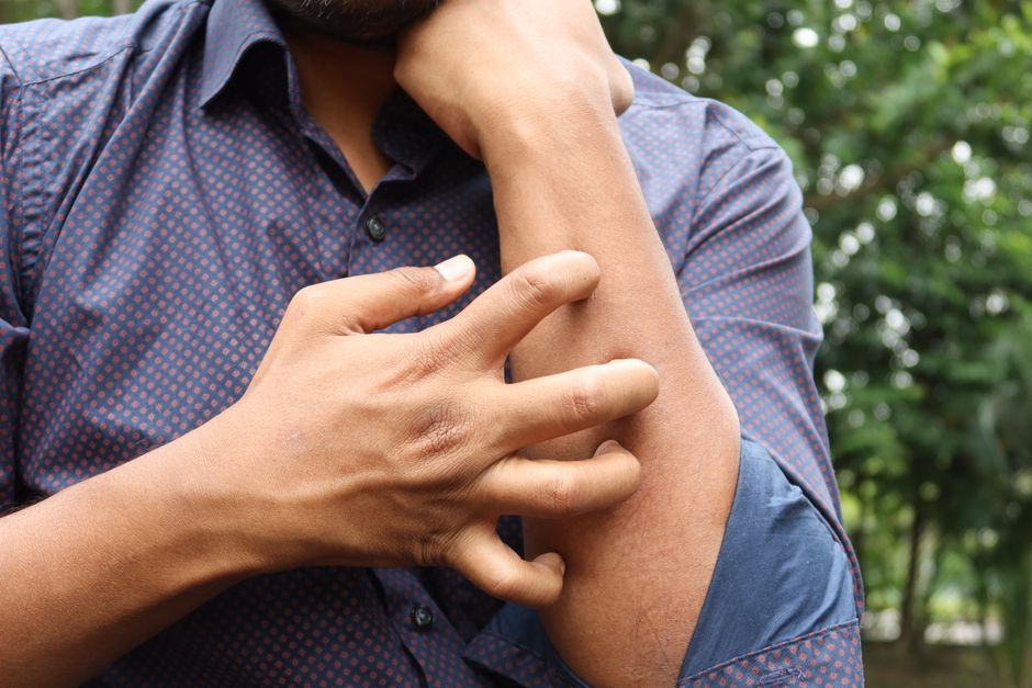 dermatitis cotton clothing tips