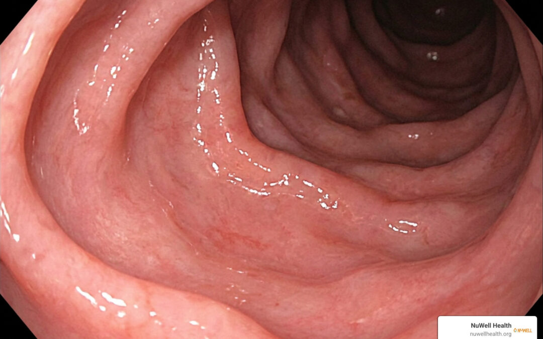 How to Repair Stomach Lining Naturally: 5 Methods That Guarantee Results
